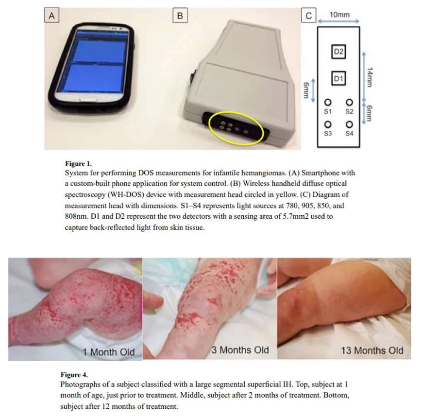 Wireless probe
