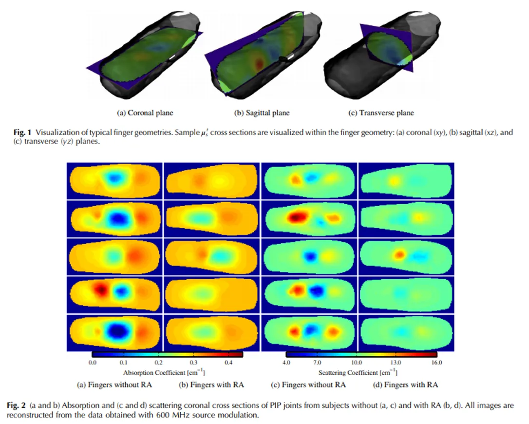 Absorption and scattering coronal cross sections of PIP joints from subjects without and with RA